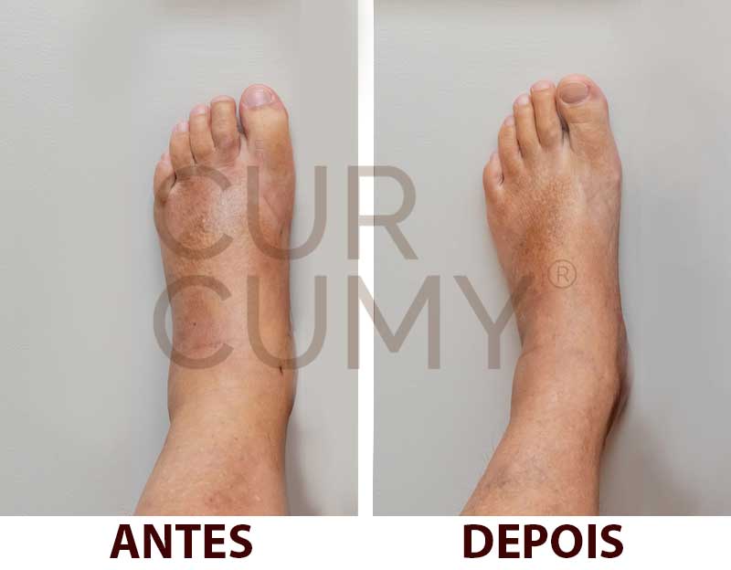 os efeitos benéficos do curcumy original em gotas são impressionantes